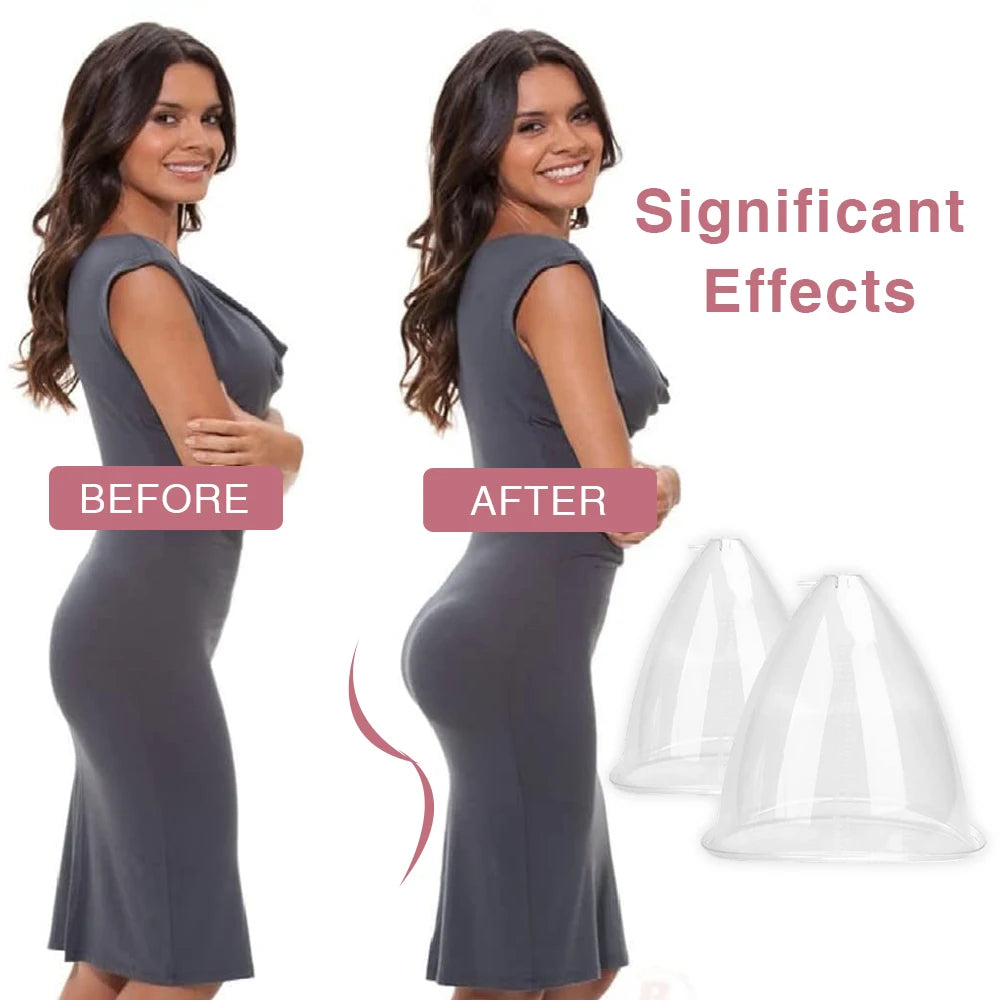 Vacuum Suction Cups and Buttock Massage Enhancer for Body Sculpting Sessions