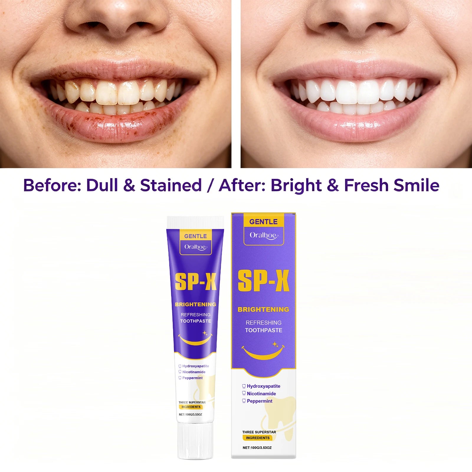 Brightening Toothpaste and Stain Remover for Daily Oral Hygiene and Whiter Smile - 3