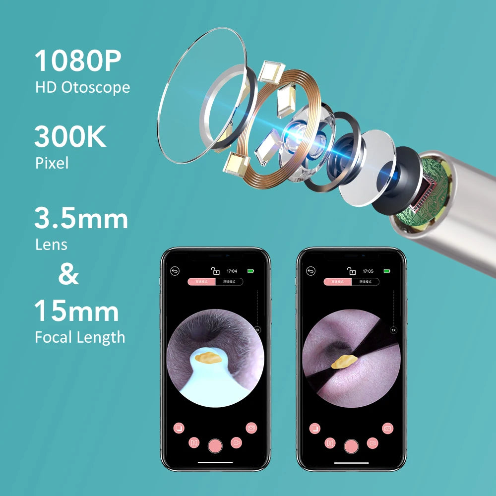 Visual Ear Wax Cleaner and Otoscope Camera for Safe Home Ear Canal Cleaning - 10