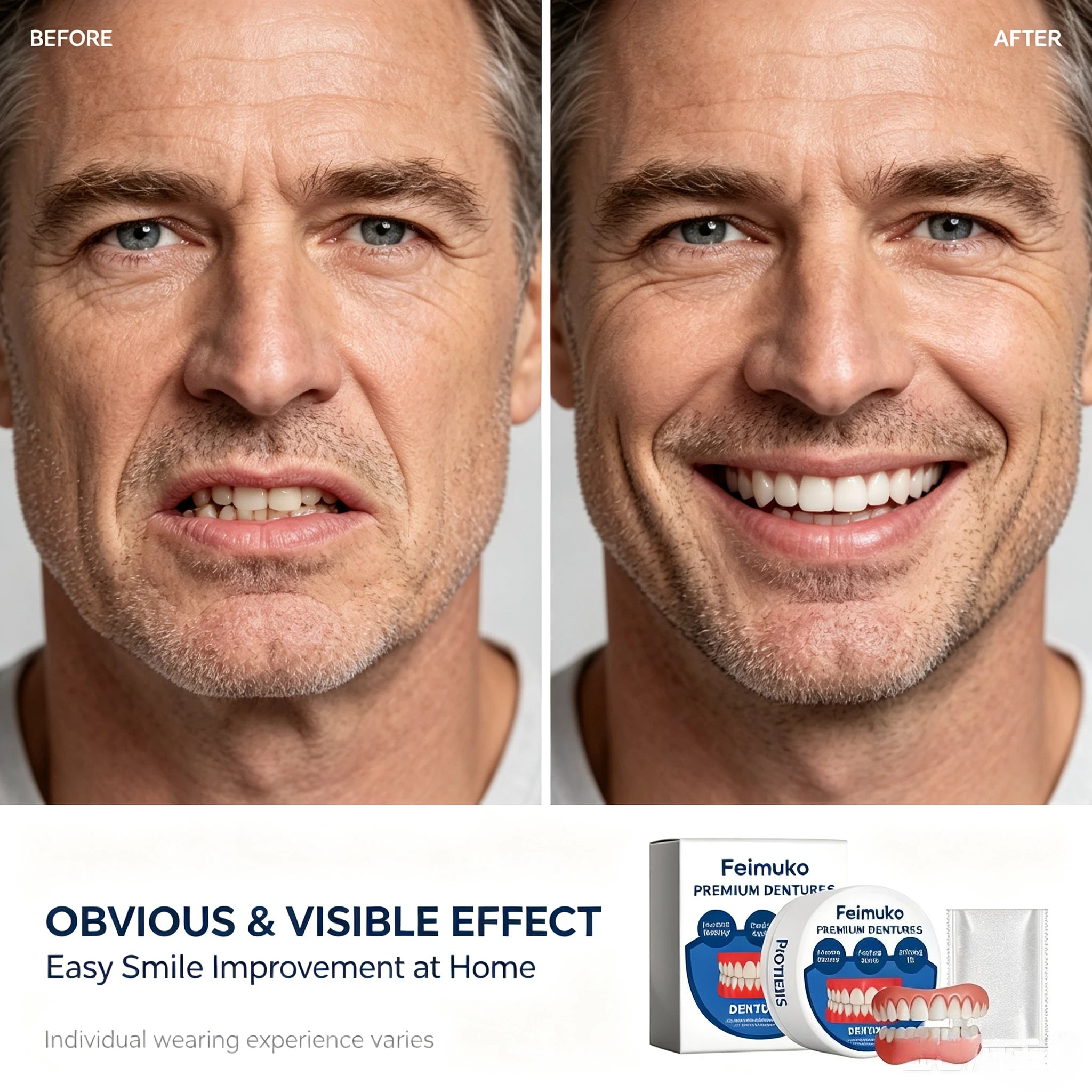 Silicone Snap On Dentures and Instant Fake Teeth for Natural Smile and Comfort - 2