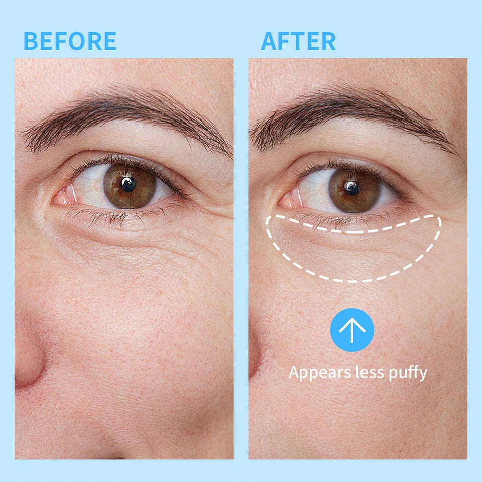 Eye Gel and Refreshing Under Eye Serum for Reducing Dark Circles and Puffiness