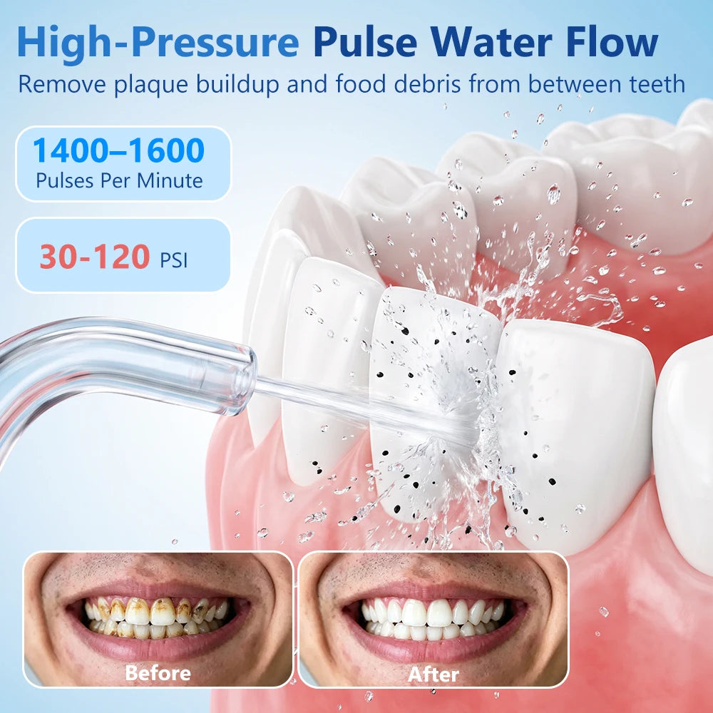 Water Dental Flosser and Oral Irrigator for Braces and Deep Teeth Cleaning Routine - 8