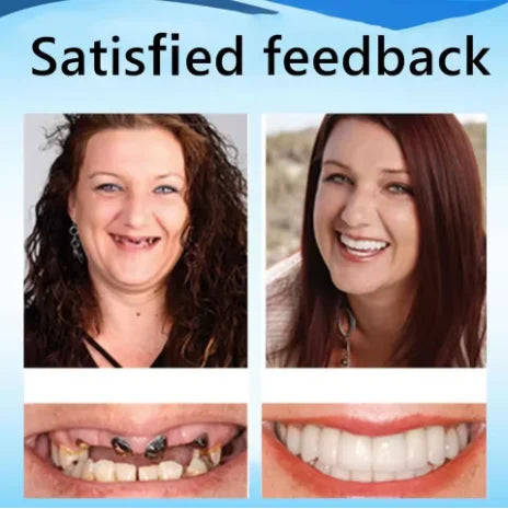 Slim Custom Fit Dentures and Flexible Cosmetic Teeth for Natural Smile Comfort - 5