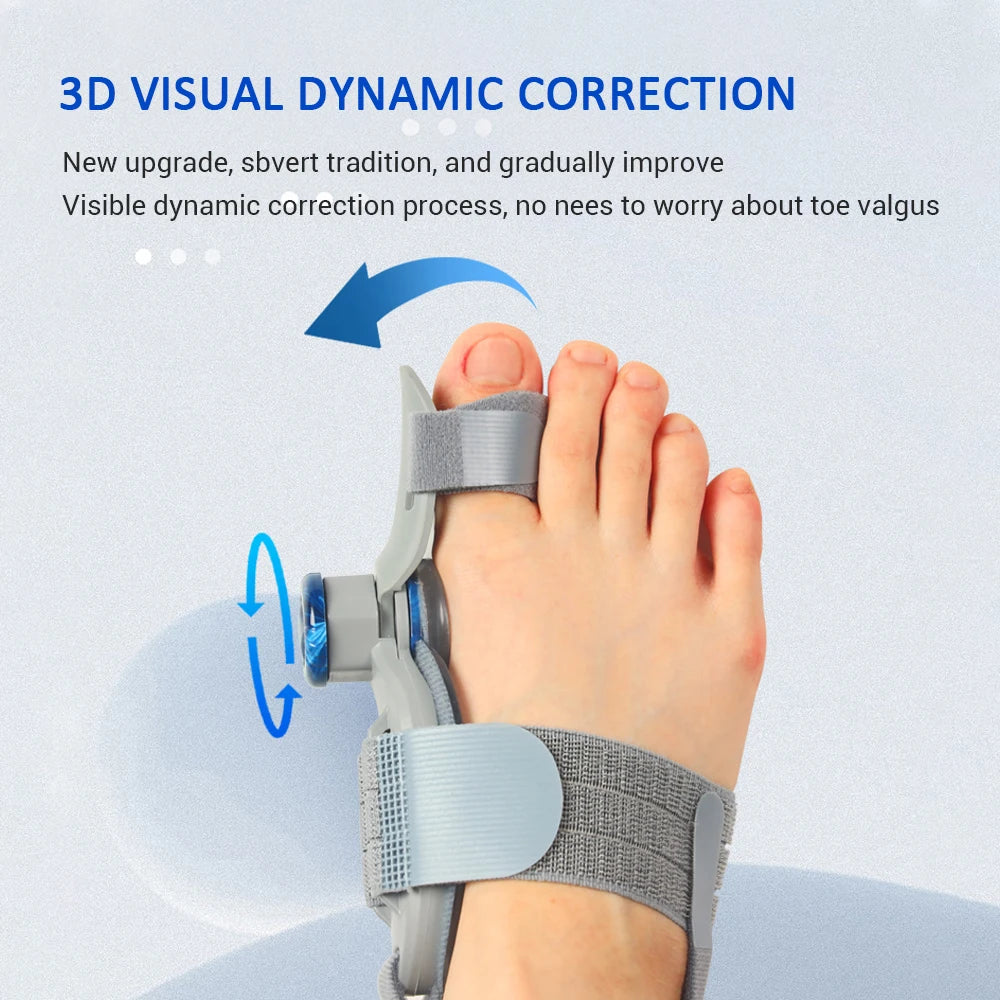 Toe Valgus Corrector and Bunion Splint for Painless Foot Alignment and Comfort - 4