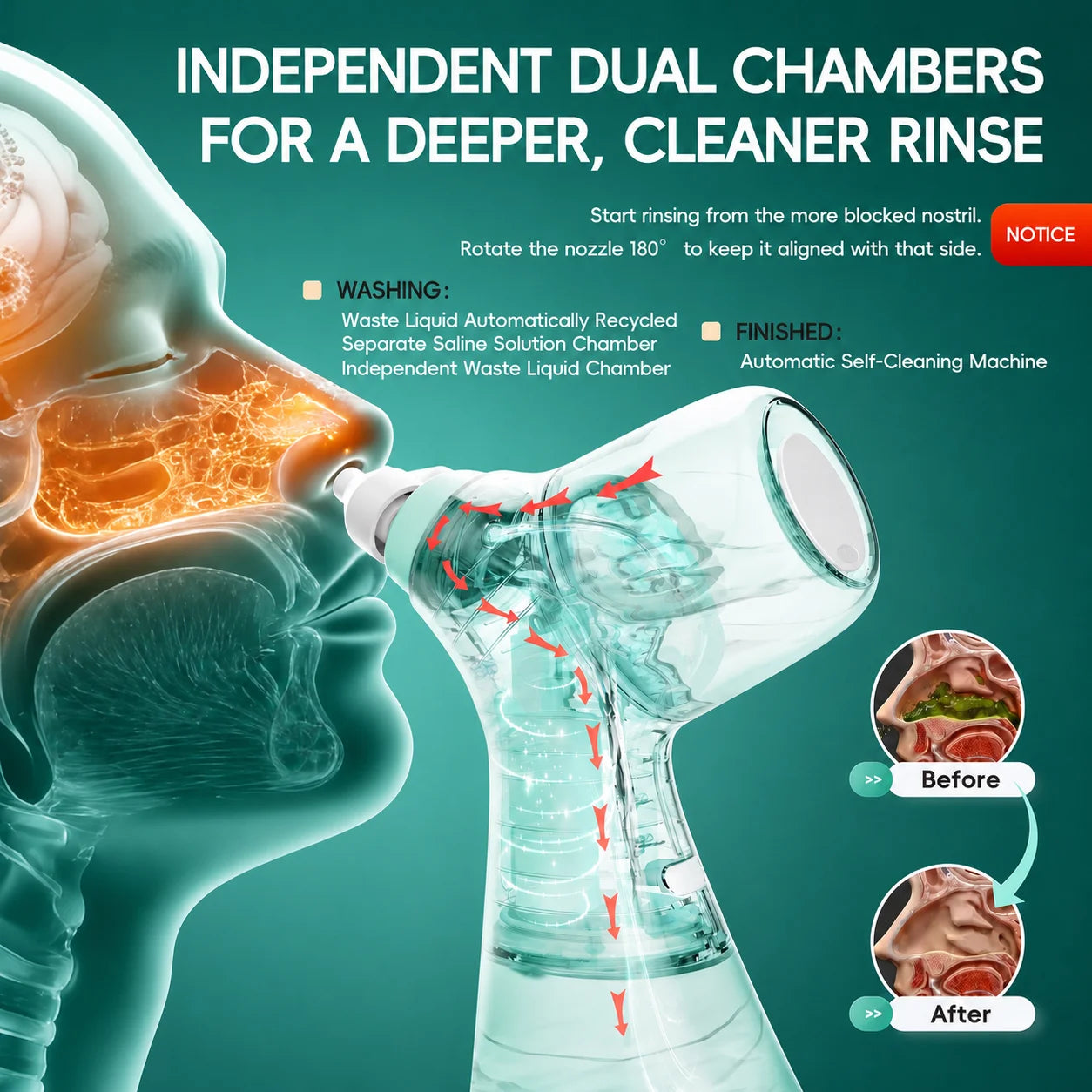 Electric Nasal Irrigator and Sinus Rinse Machine for Daily Allergy Relief - 4