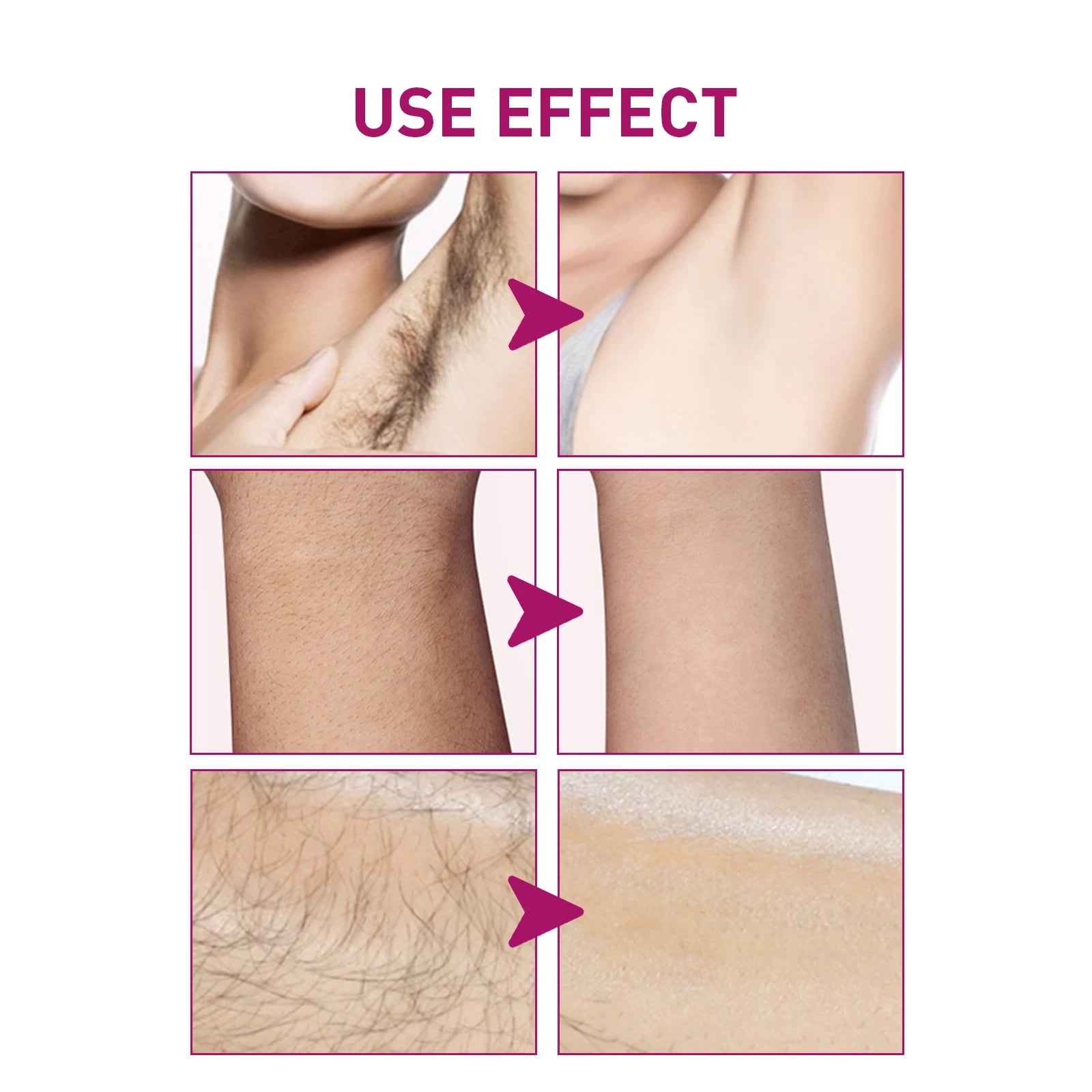 Hair Removal Cream and Depilatory Lotion for Painless Grooming and Smooth Skin - 4