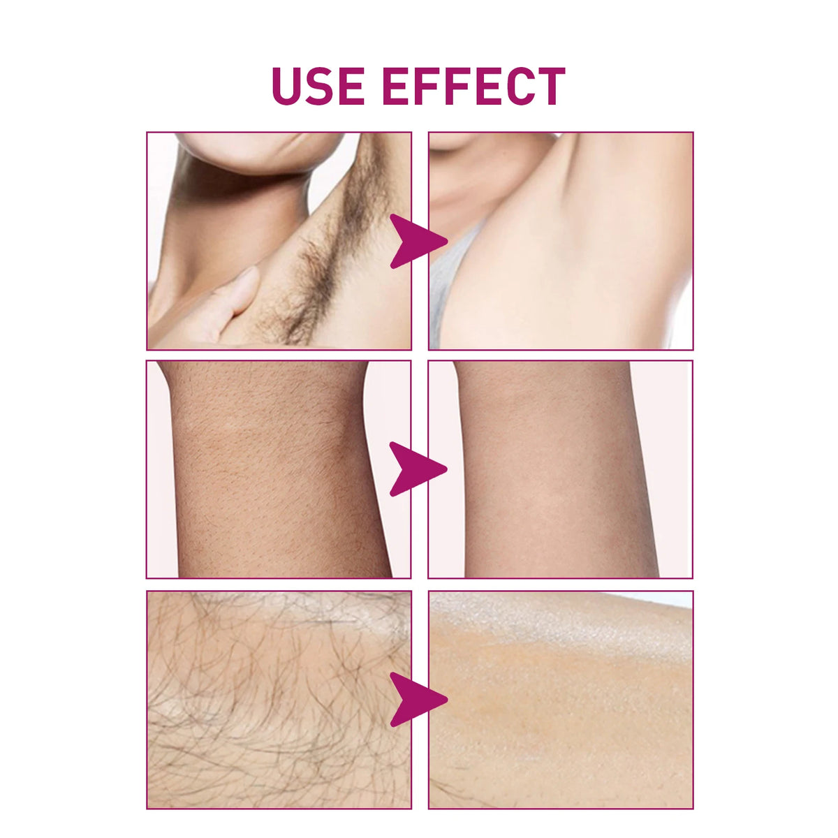 Hair Removal Cream and Depilatory Lotion for Painless Grooming and Smooth Skin