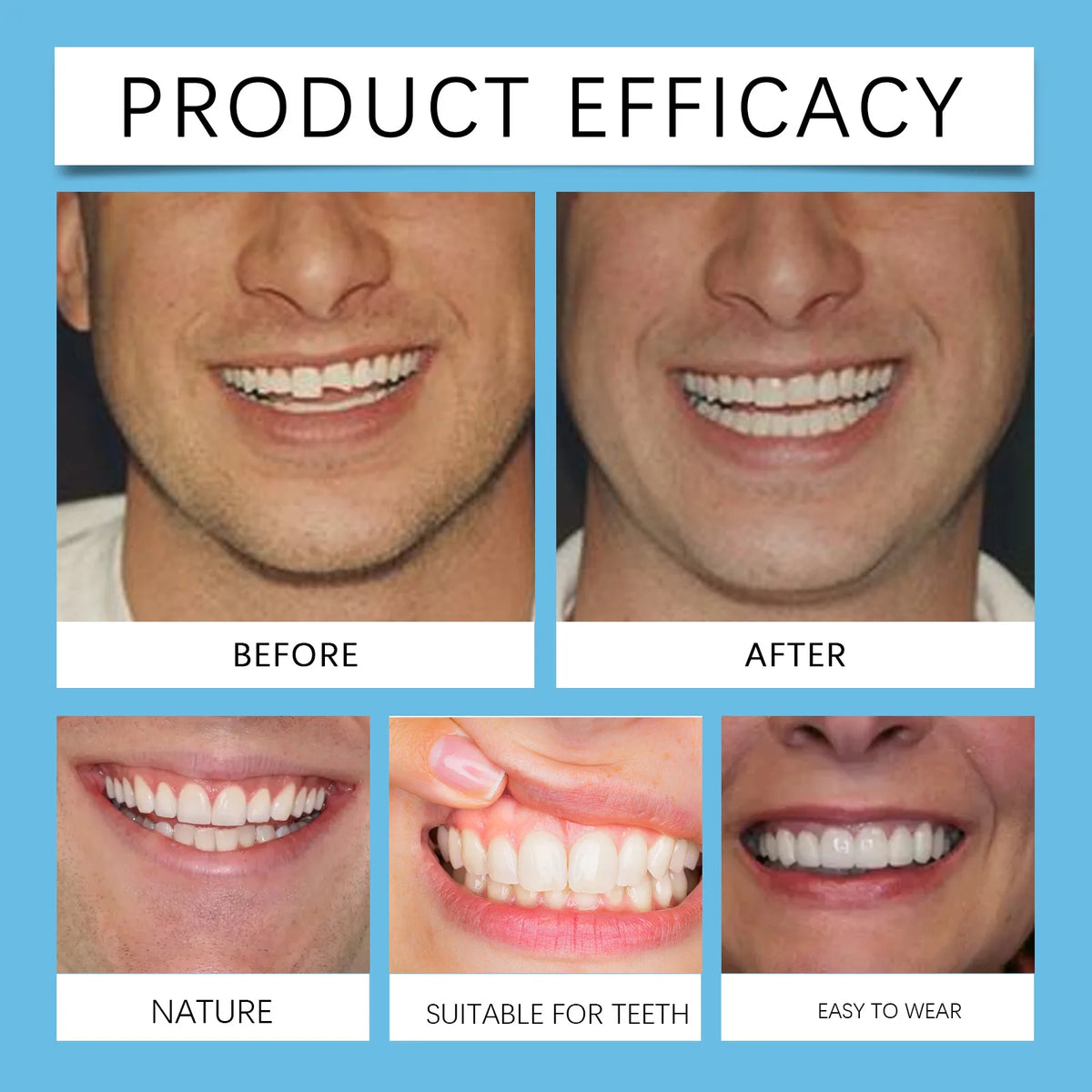 Silicone Denture Set and Temporary Veneers for Restoring Your Perfect Smile