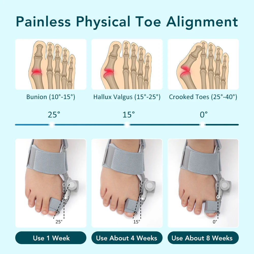 Toe Valgus Corrector and Bunion Splint for Painless Foot Alignment and Comfort - 15