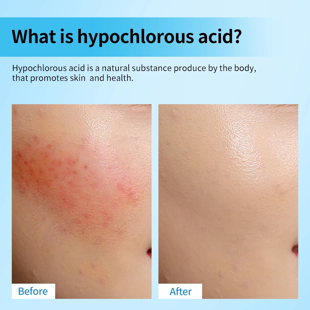 Hypochlorous Acid Spray and Facial Toner for Daily Skin Rescue and Calming - 3