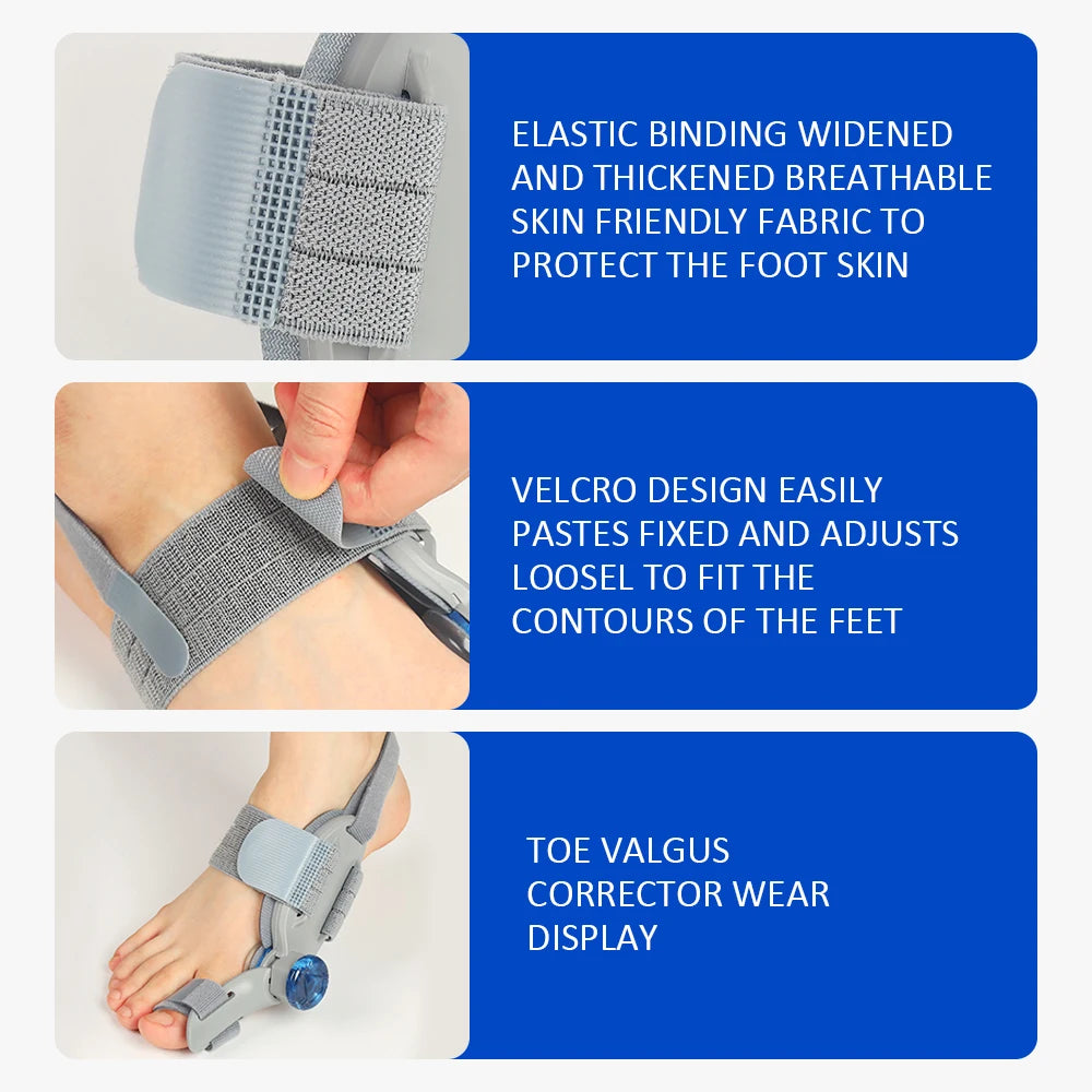 Toe Valgus Corrector and Bunion Splint for Painless Foot Alignment and Comfort