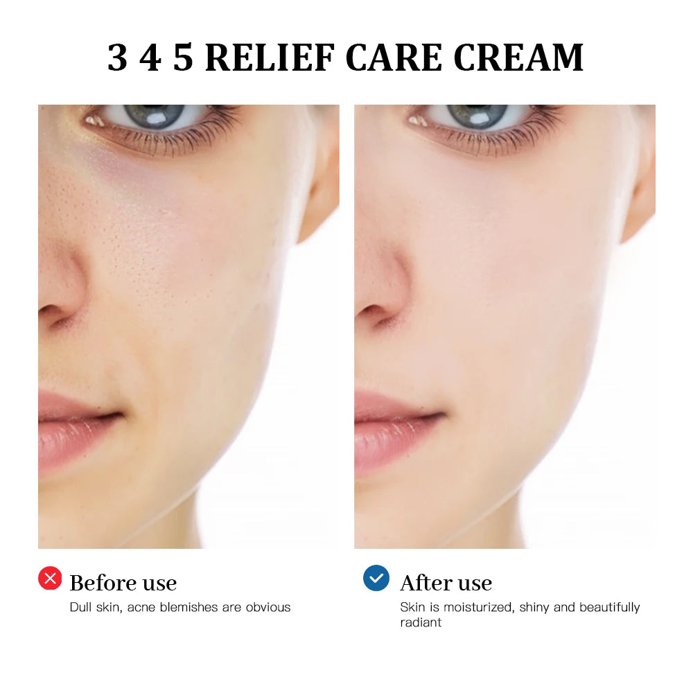 345 Relief Cream and Moisturizing Face Lotion for Daily Skincare Routine - 3