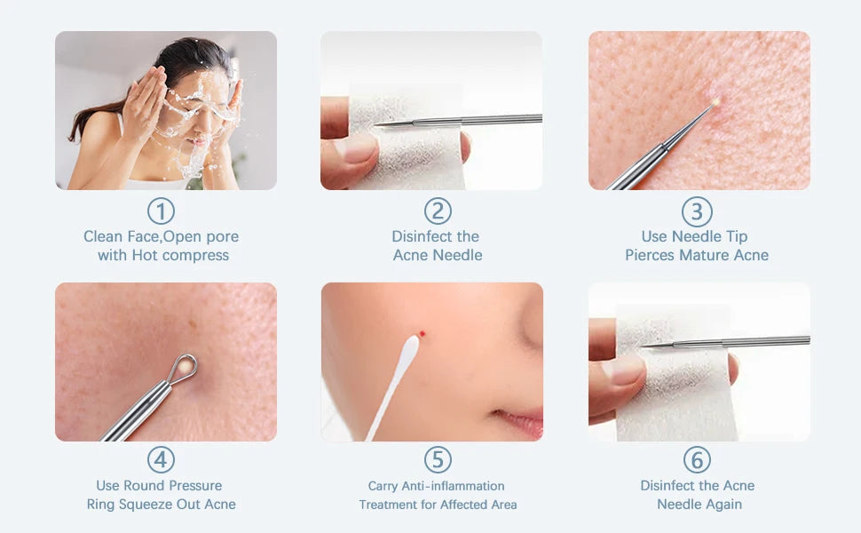Blackhead Remover Kit and Pimple Popper Tools for Clear Facial Skin Care