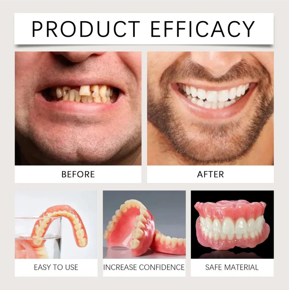 Resin Fake Teeth and Instant Smile Veneers for Daily Confidence and Social Events - 3