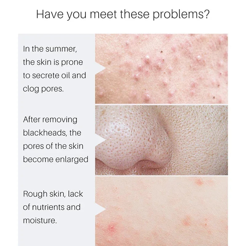 Pore Shrinking Serum and Face Tightening Essence for Smooth Radiant Skin - 3