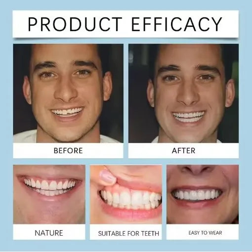 Flexible Silicone Dentures and Cosmetic Teeth for a Confident Natural Smile