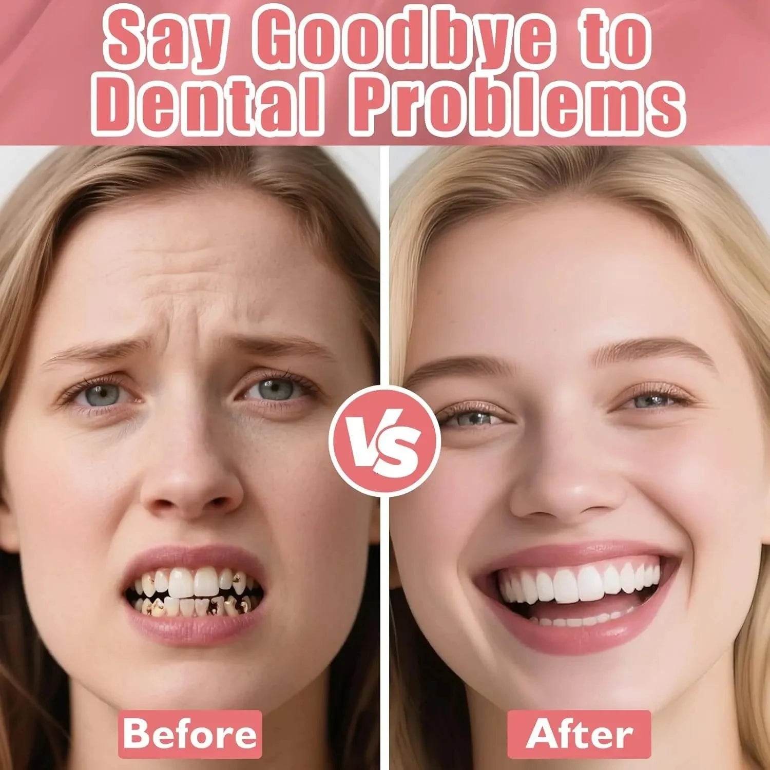 Full Denture Set and Temporary False Teeth Veneers for a Confident Daily Smile - 4