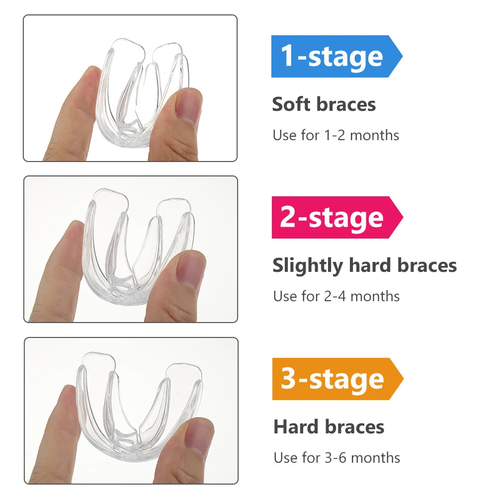 Dental Orthodontic Braces and Teeth Straightener for Children During Growing Years - 4