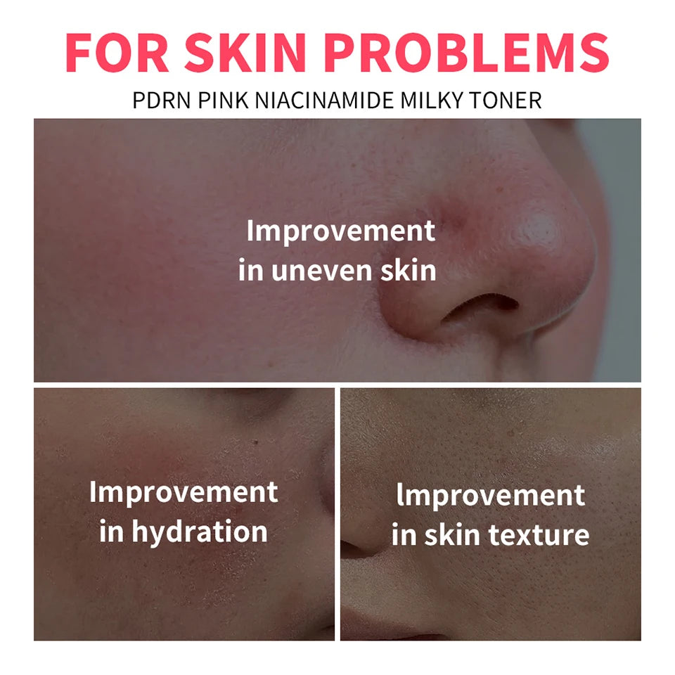 PDRN Niacinamide Toner and Moisturizing Facial Lotion for Daily Skin Hydration