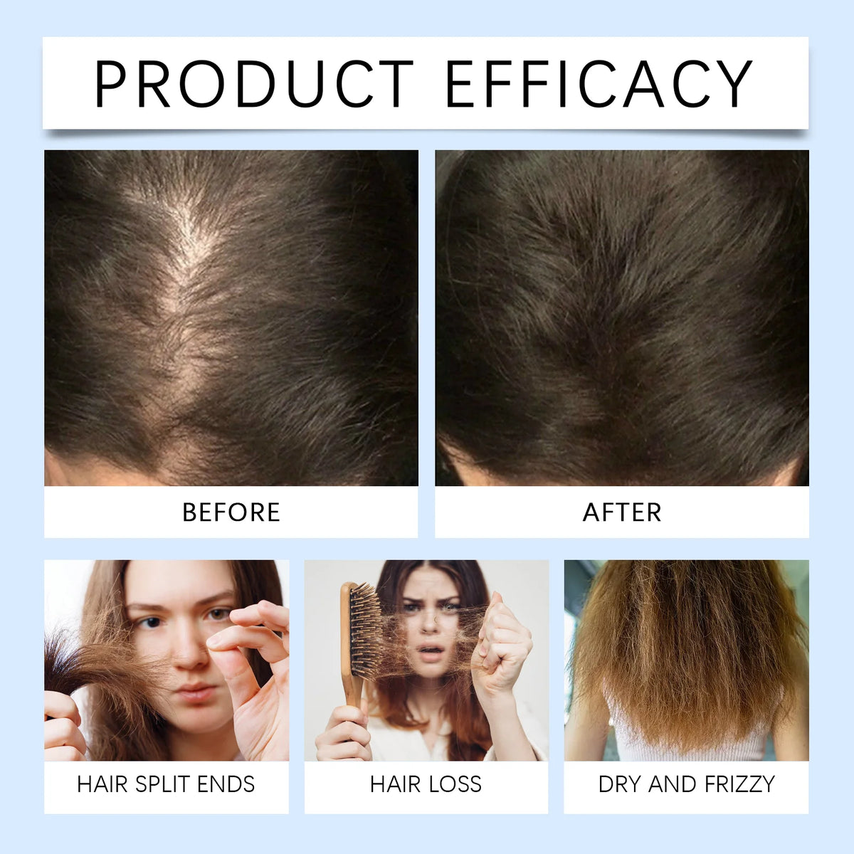 Rosemary Hair Serum and Scalp Roller for Thicker Fuller Hair Growth Routine