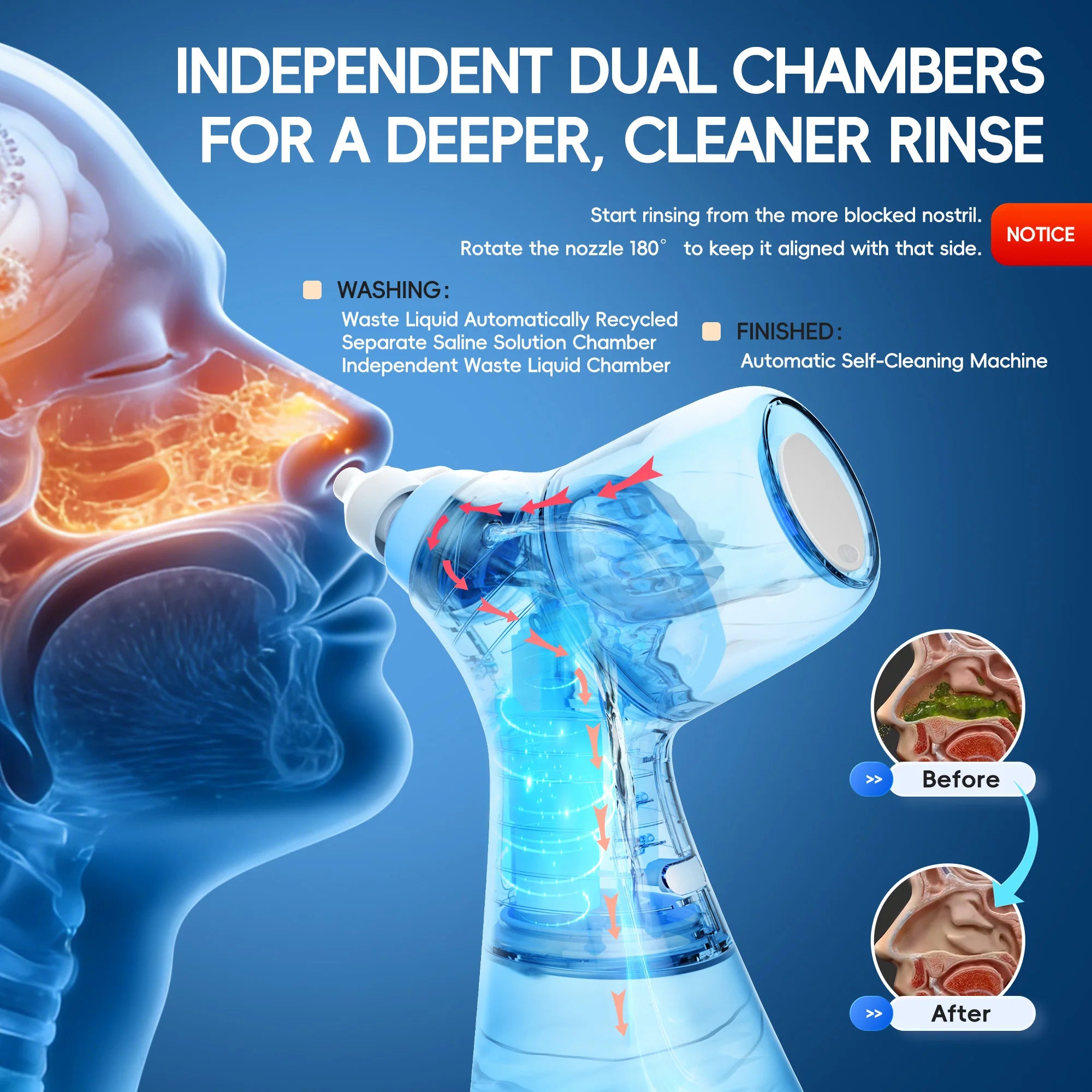 Nasal Irrigation System and Sinus Rinse Kit for Daily Congestion Relief Care - 2