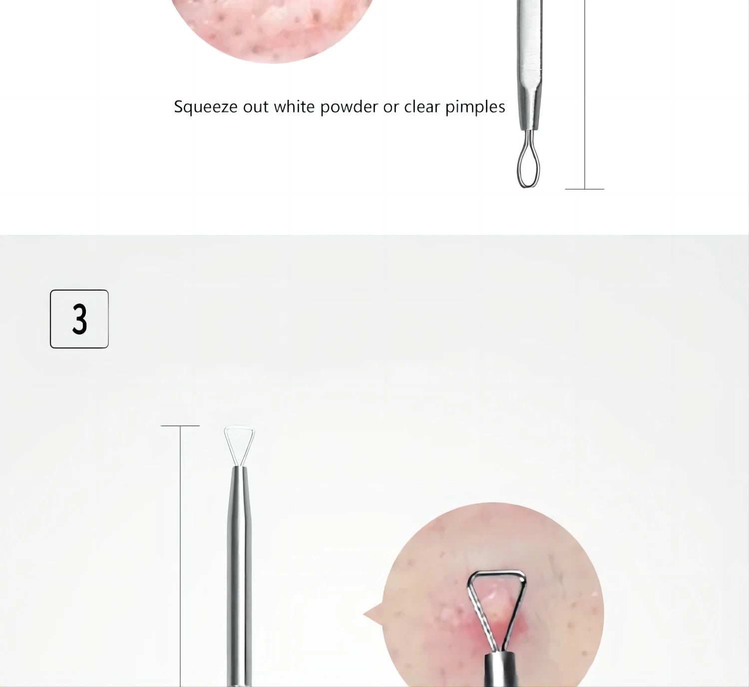 Blackhead Remover Kit and Pimple Popper Tools for Clear Facial Skin Care - 14
