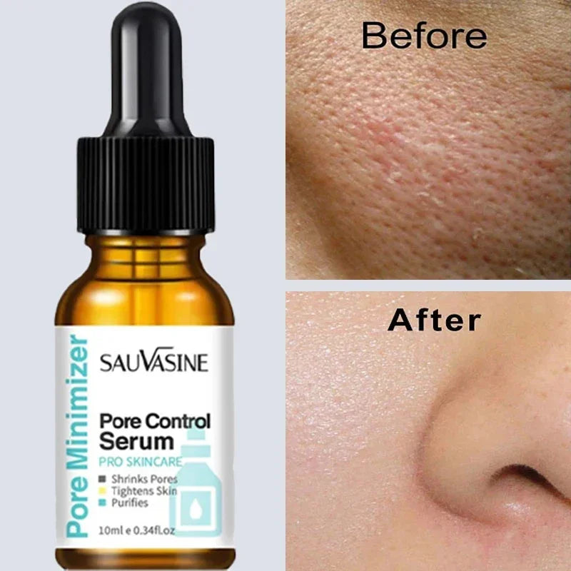 Pore Shrinking Serum and Face Tightening Essence for Smooth Radiant Skin