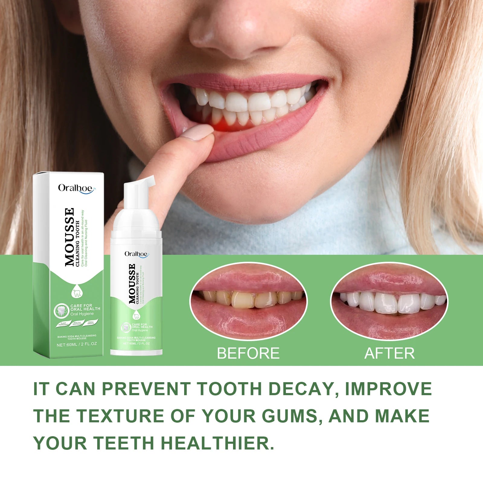 Whitening Foaming Toothpaste and Dental Mousse for Daily Teeth Stain Removal - 8