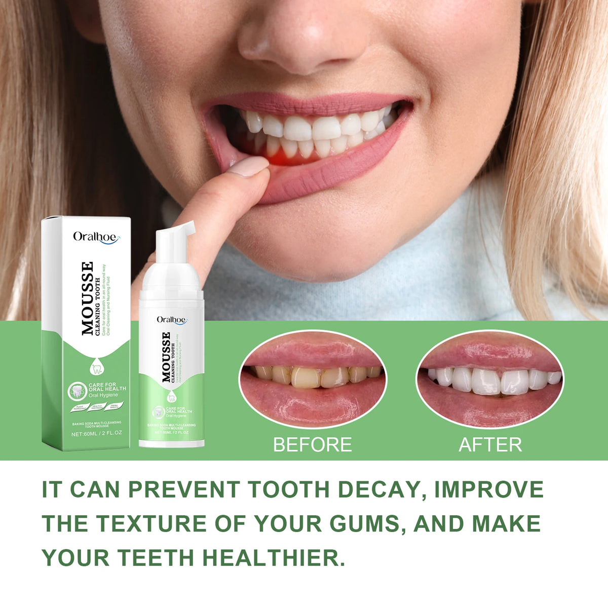 Whitening Foaming Toothpaste and Dental Mousse for Daily Teeth Stain Removal