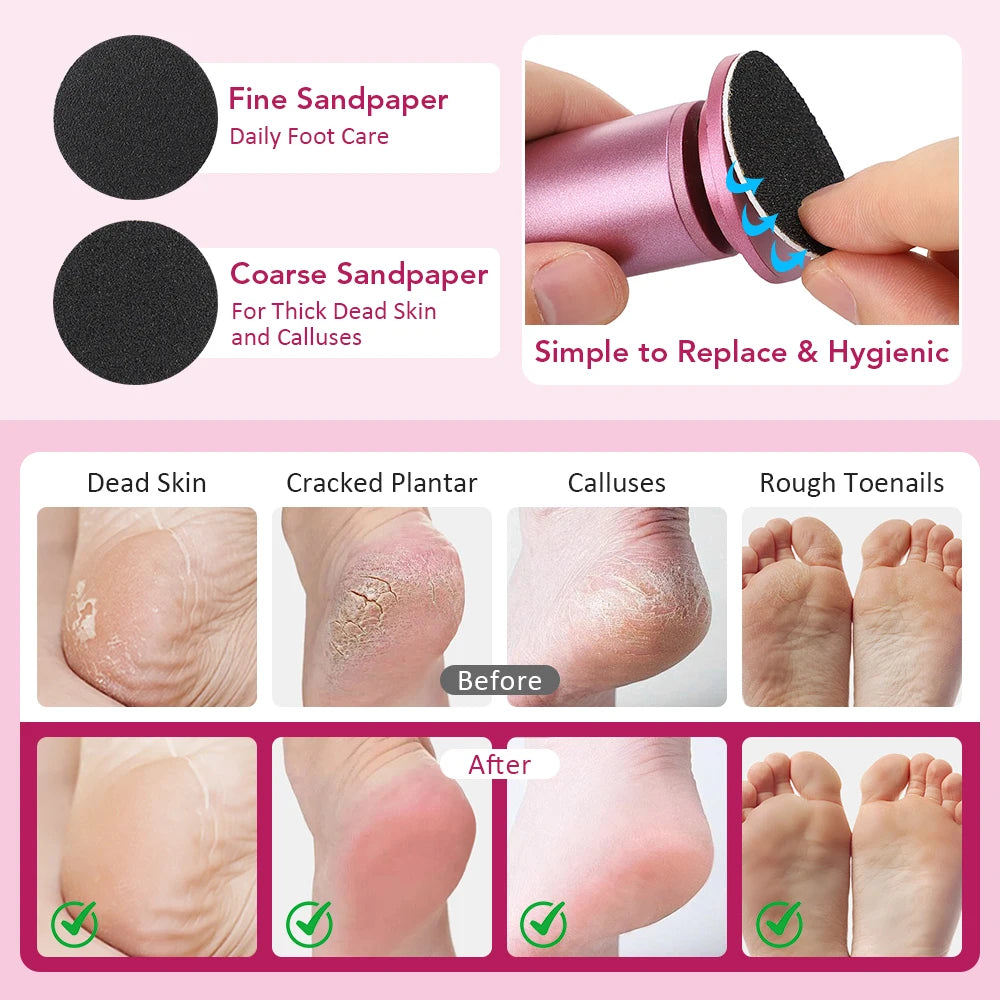 Electric Callus Remover and Foot File Pedicure Tool for Smooth Salon Heels - 4