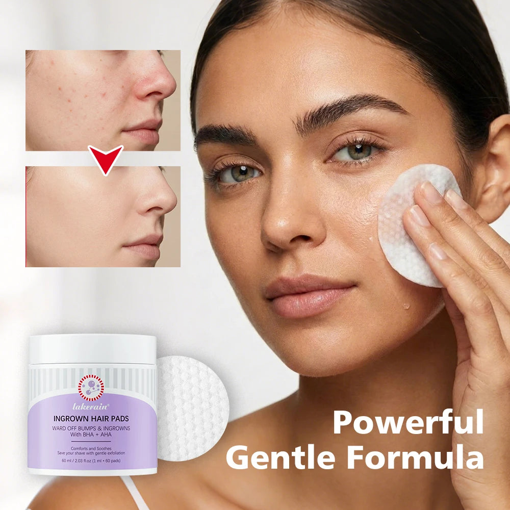 Ingrown Hair Pads and Razor Bump Treatment for Smooth Skin After Shaving