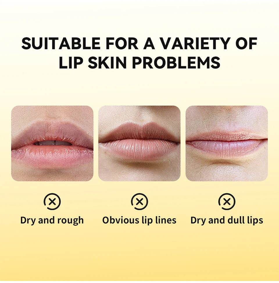 Propolis Lip Gel and Hydrating Lip Mask for Overnight Repair and Dry Lip Care - 8