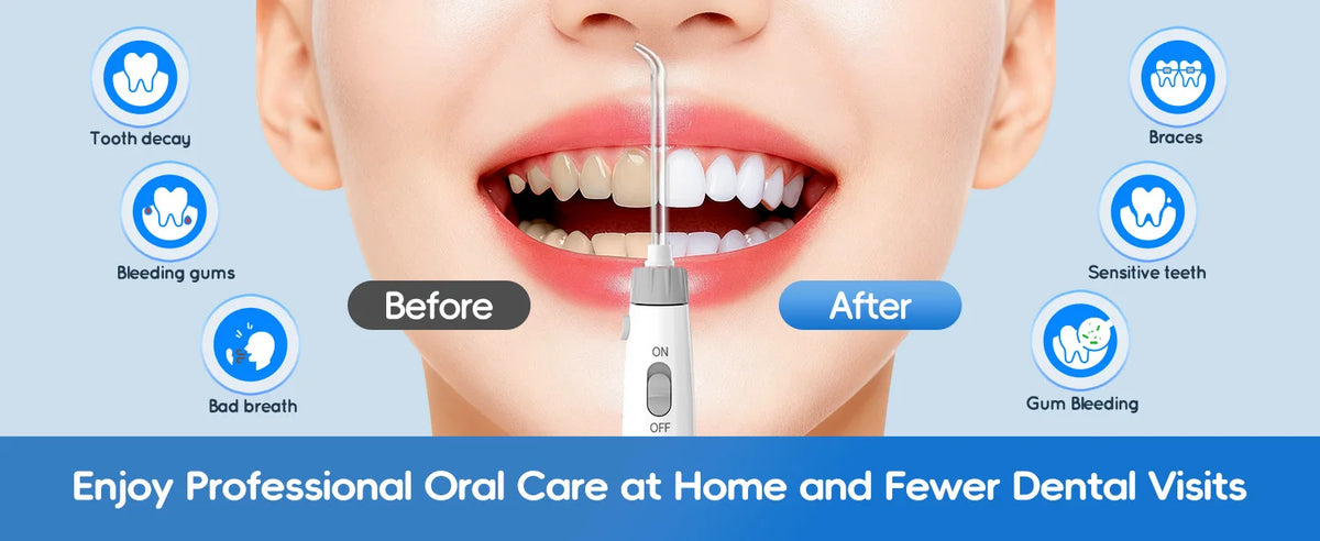 Water Flosser and Oral Irrigator for Deep Teeth Cleaning and Gum Health Care