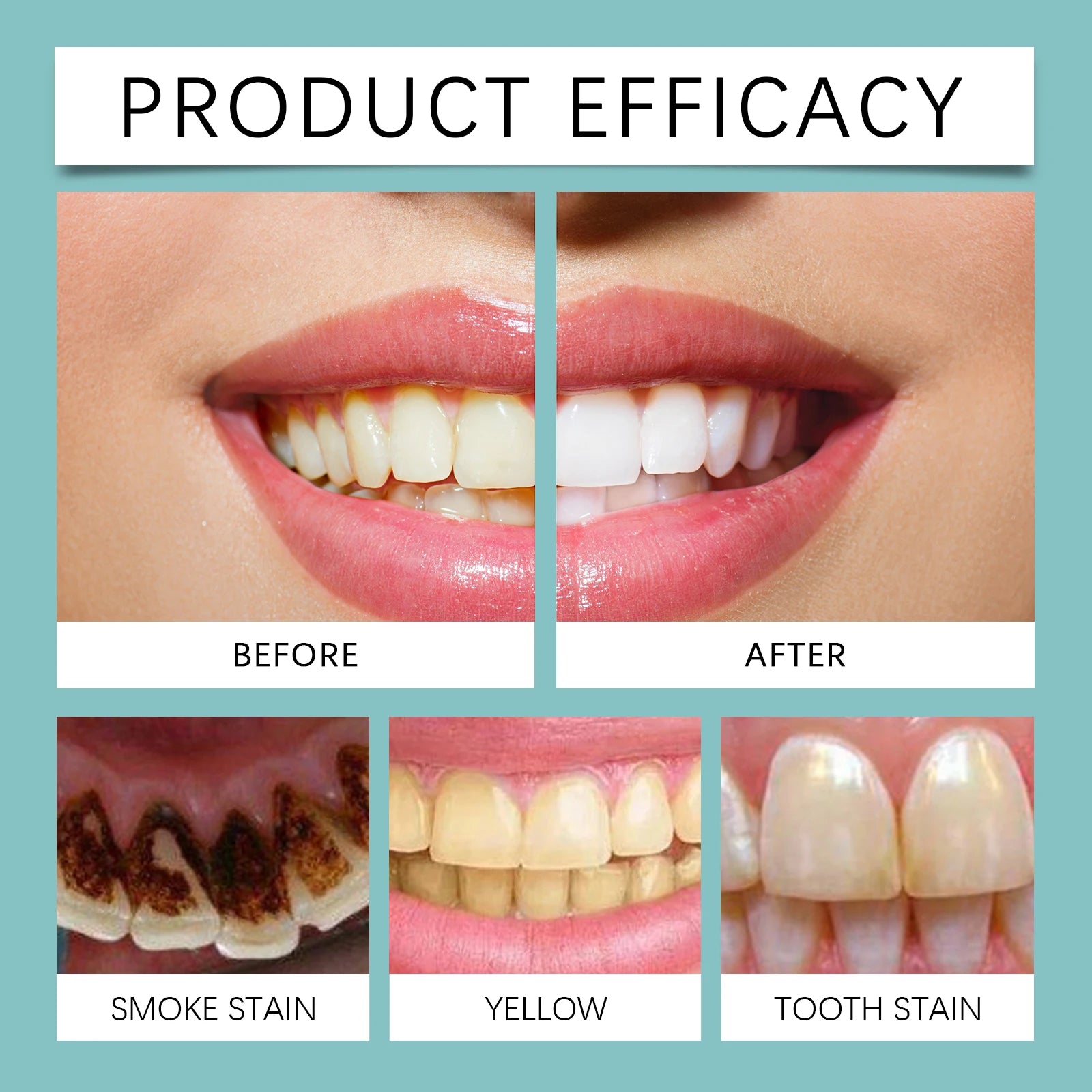 Teeth Whitening Paint and Dental Brightener Gel for a Brighter Confident Smile - 11