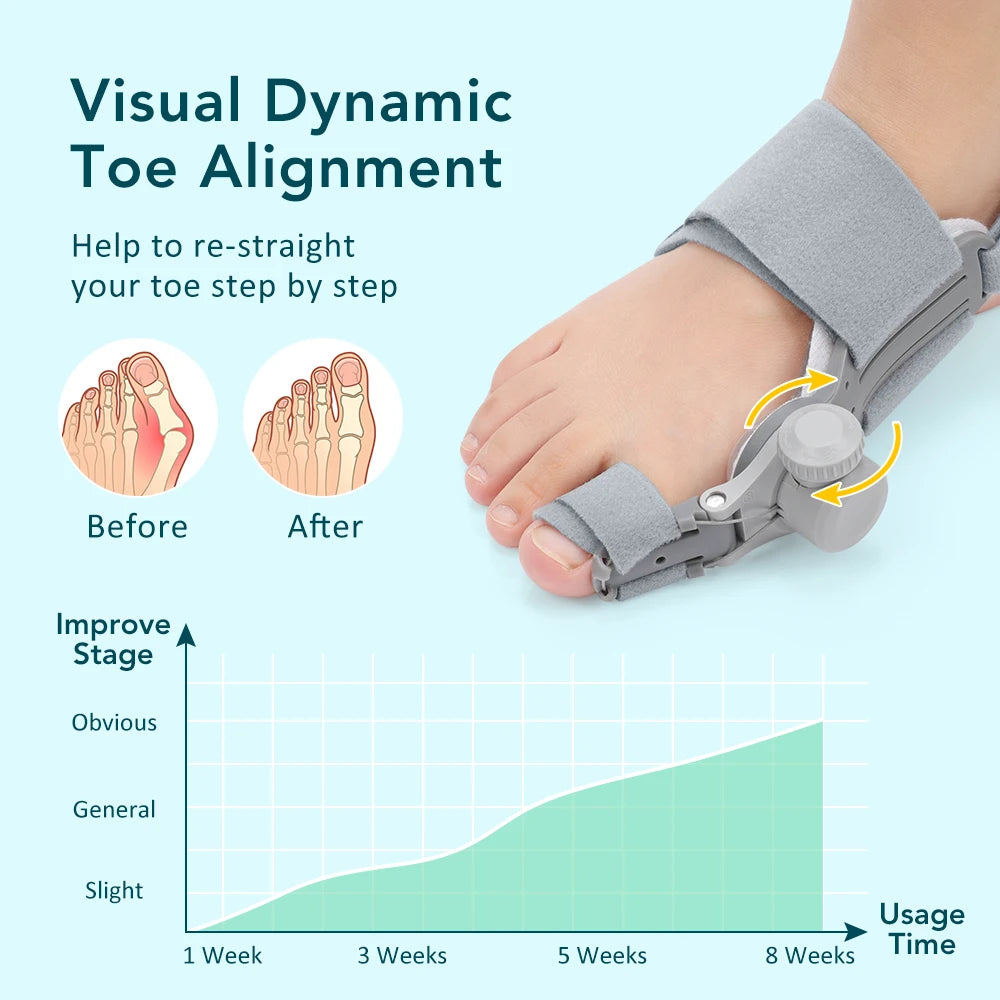 Toe Valgus Corrector and Bunion Splint for Painless Foot Alignment and Comfort
