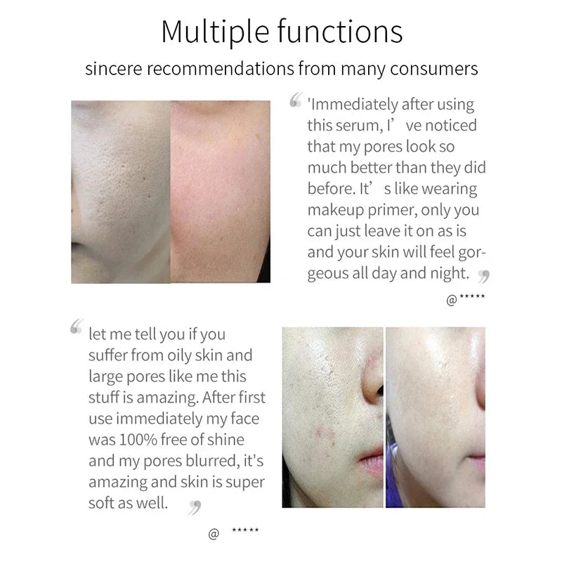 Pore Shrinking Serum and Face Tightening Essence for Smooth Radiant Skin - 14