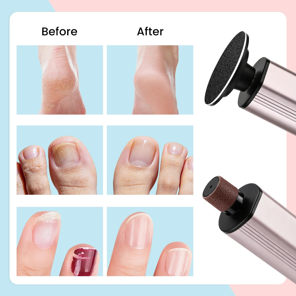 Electric Foot File and Callus Remover for Smooth Heels and Professional Pedicures