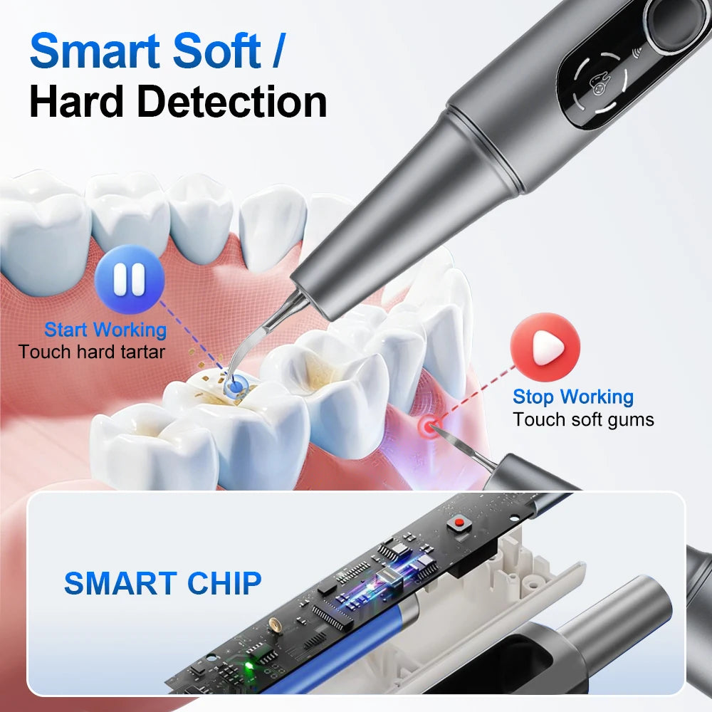 Visual Ultrasonic Dental Scaler and Tooth Tartar Remover for Home Oral Care