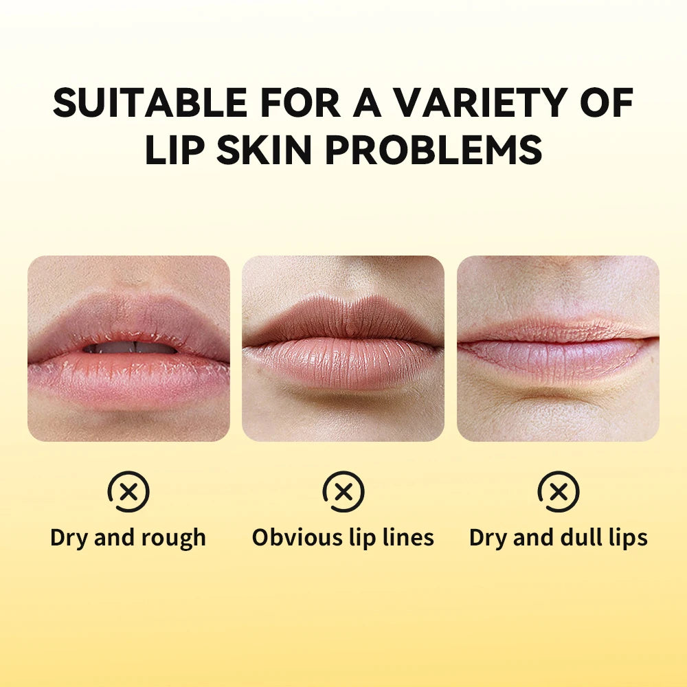 Propolis Lip Gel and Hydrating Lip Mask for Overnight Repair and Dry Lip Care - 5
