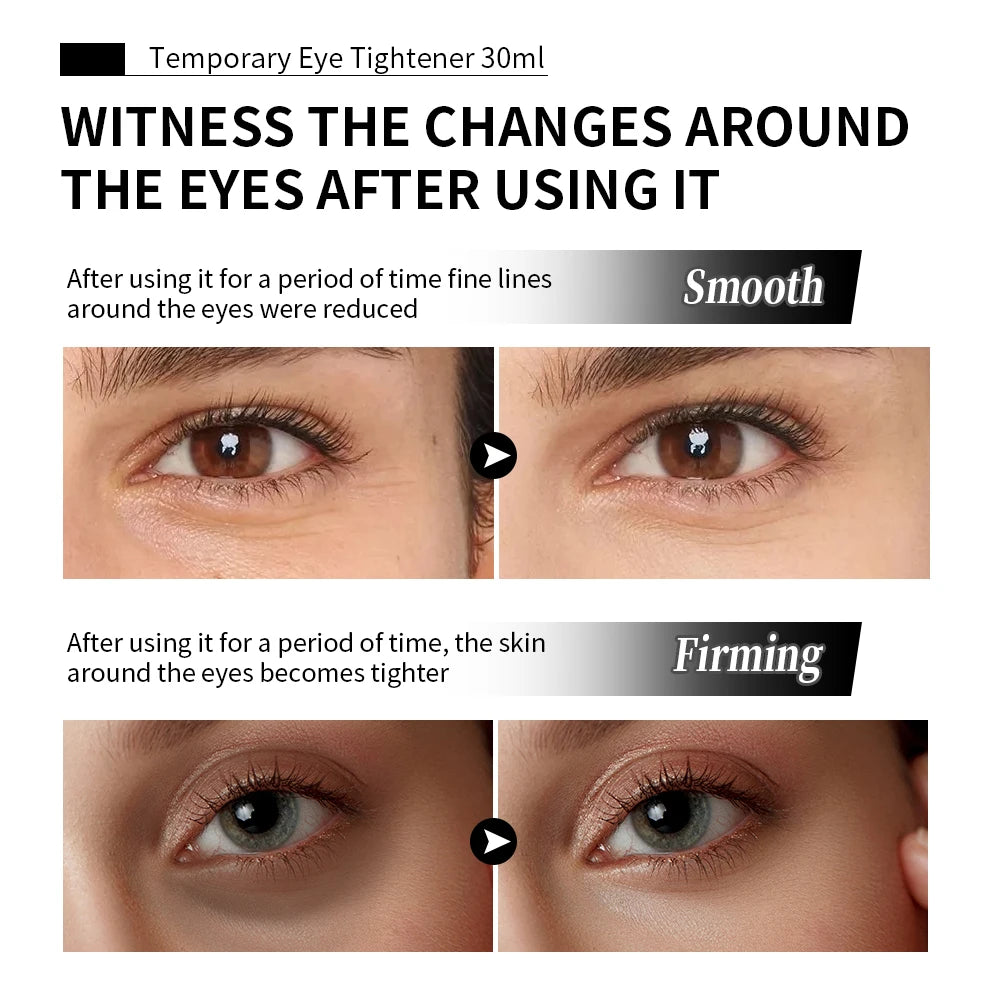 Temporary Eye Tightener and Anti Aging Cream for Smooth Youthful Looking Skin