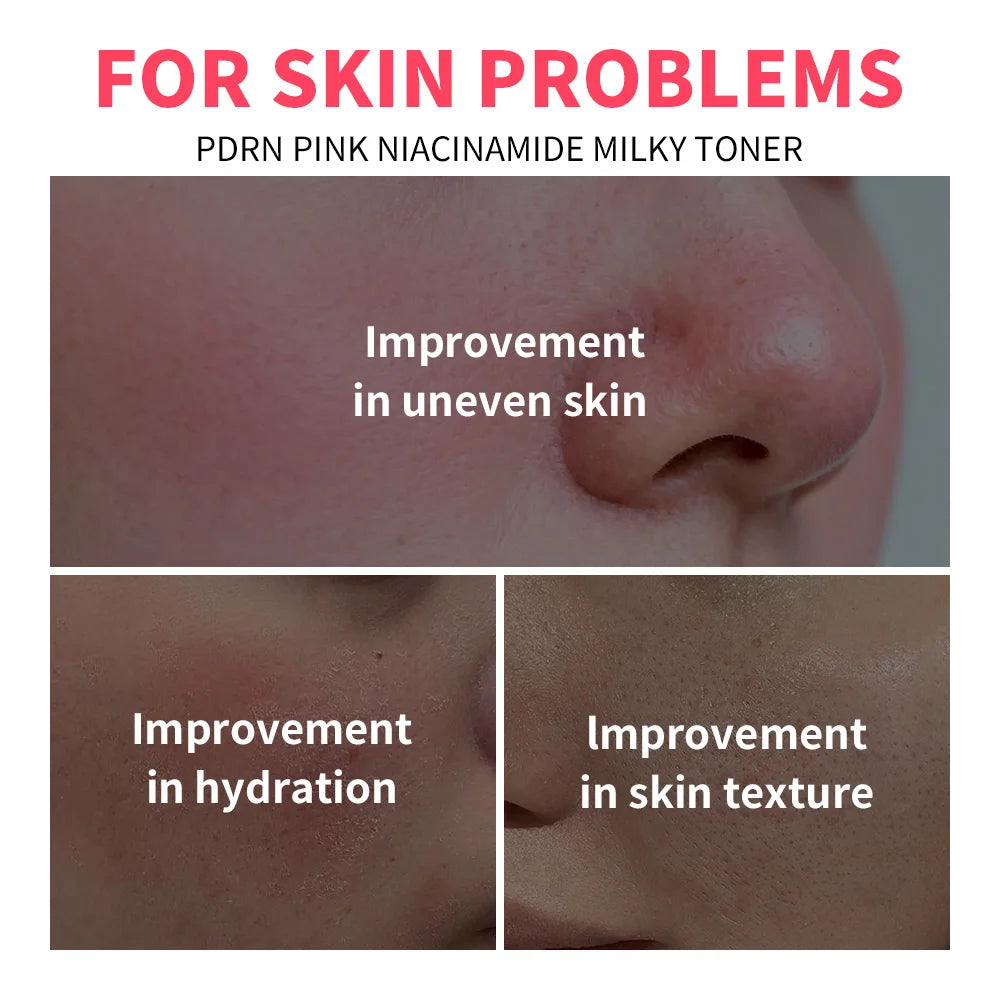PDRN Niacinamide Toner and Moisturizing Facial Lotion for Daily Skin Hydration