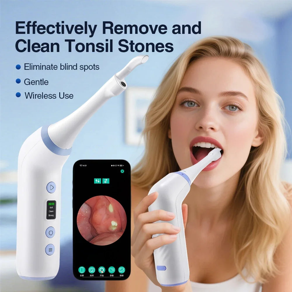 Tonsil Stone Remover and Oral Vacuum Tool for Clearing Bad Breath at Home - 1