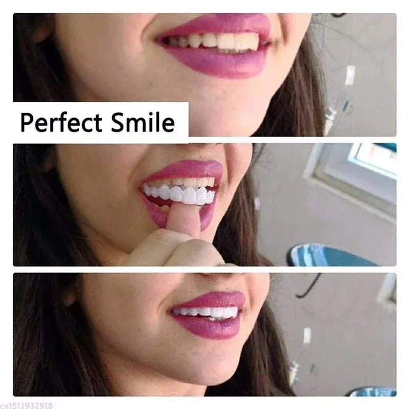 Snap on Veneers and Temporary Fake Teeth for Instant Smile Confidence Results