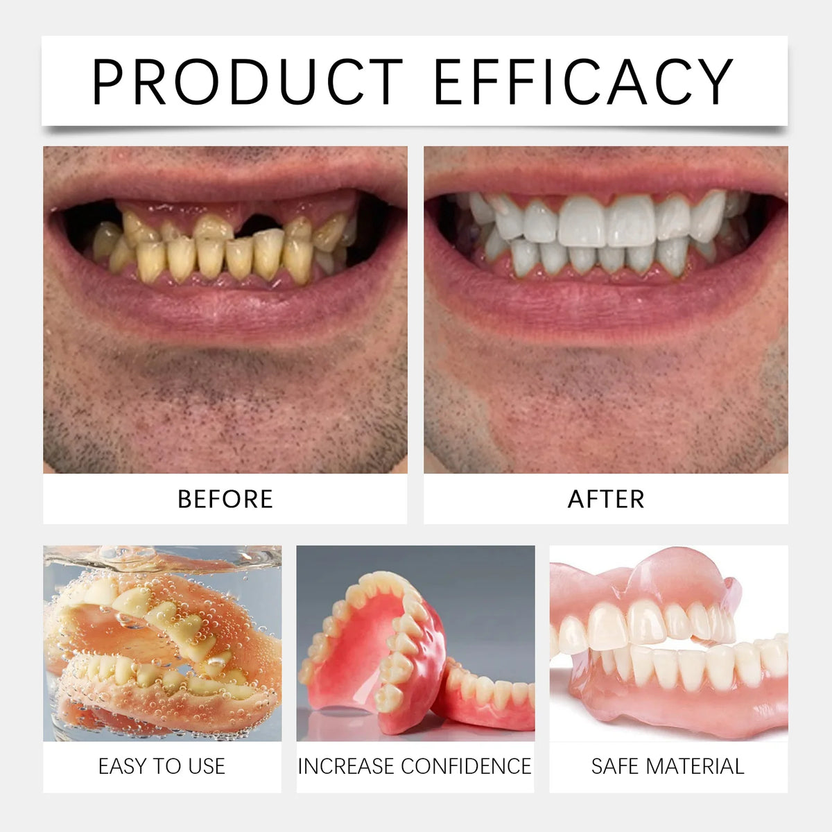 Soft Silicone Denture Kit and Fake Teeth Set for Natural Smile and Tooth Restoration