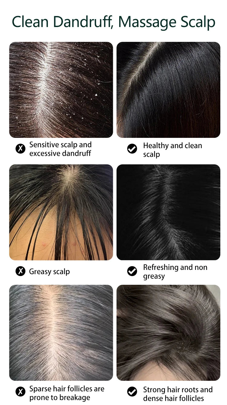 Scalp Massager and Electric Head Scratcher for Deep Relaxation and Hair Care