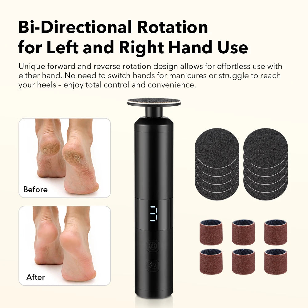 Electric Foot File and Callus Remover for Smooth Heels and Professional Home Care - 2