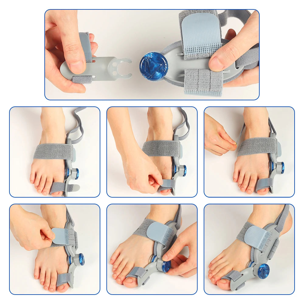 Toe Valgus Corrector and Bunion Splint for Painless Foot Alignment and Comfort