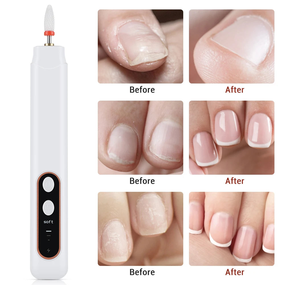 Electric Nail Drill and Manicure File Set for Salon Quality Home Nail Care - 5