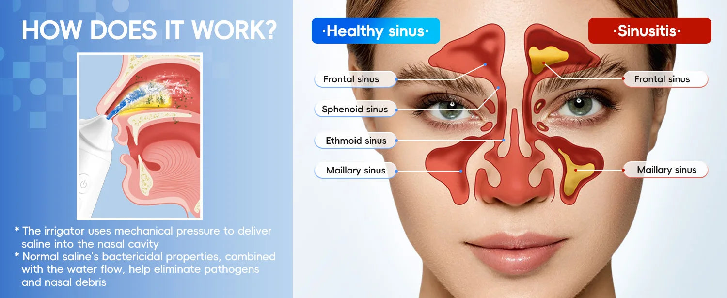 Electric Nasal Irrigator and Sinus Rinse Machine for Daily Allergy Relief at Home - 9