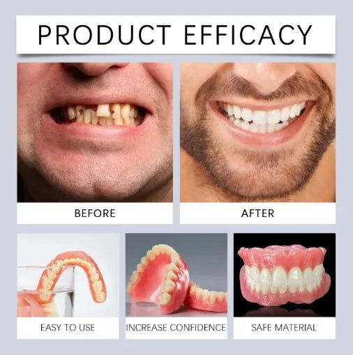 Silicone Full Mouth Dentures and Realistic Fake Teeth for Daily Smile Comfort